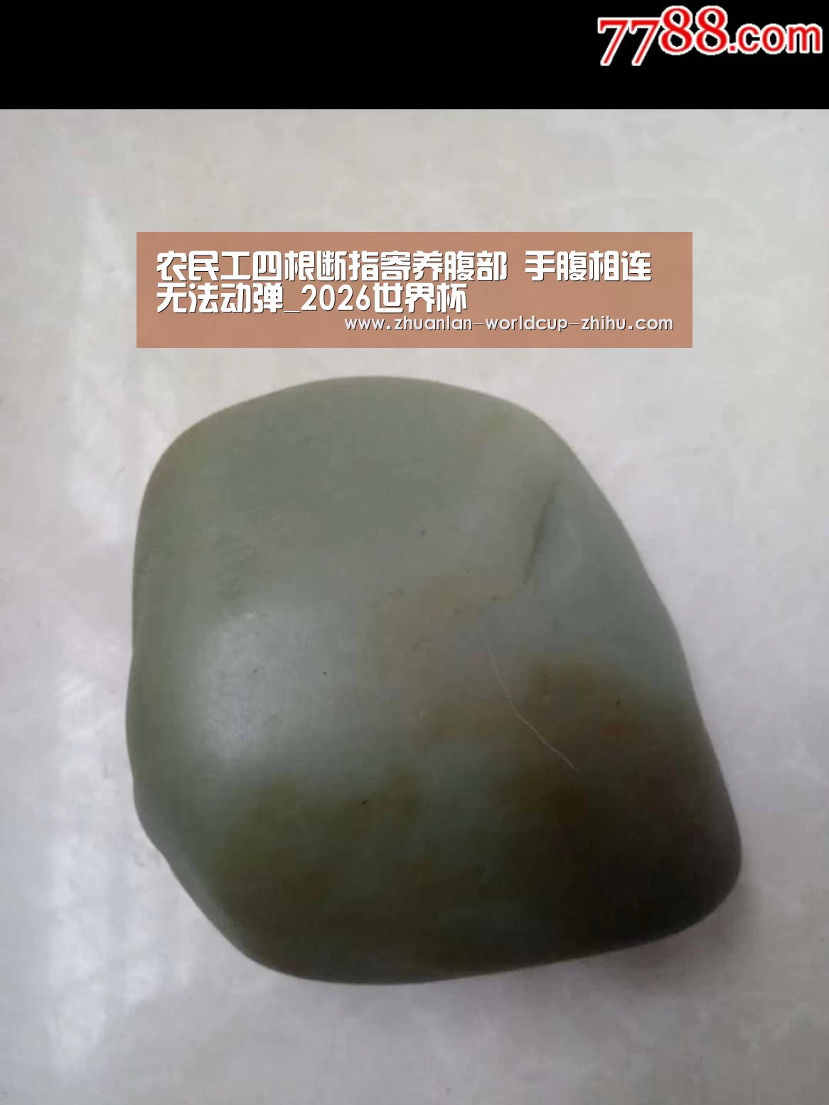 农民工四根断指寄养腹部 手腹相连无法动弹_2026世界杯(图2) 2026世界杯官网